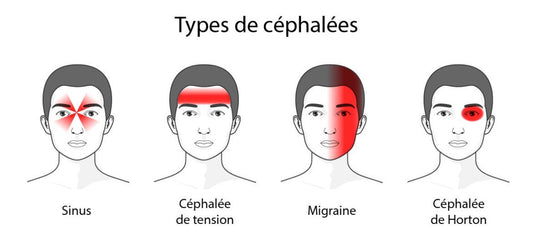 La migraine une souffrance Sénégalaise - NRJSOLAIRE